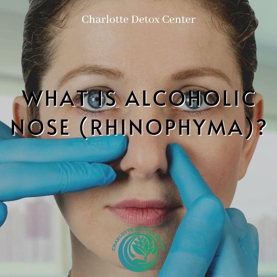 What Is Alcoholic Nose?